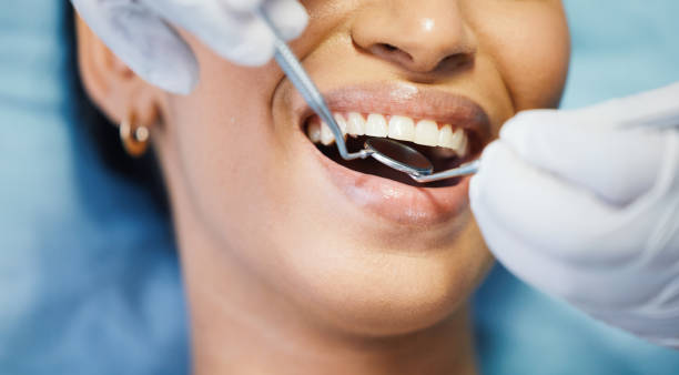 Best Emergency Treatment for Dental Infections or Abscesses in Farmingdale, NJ